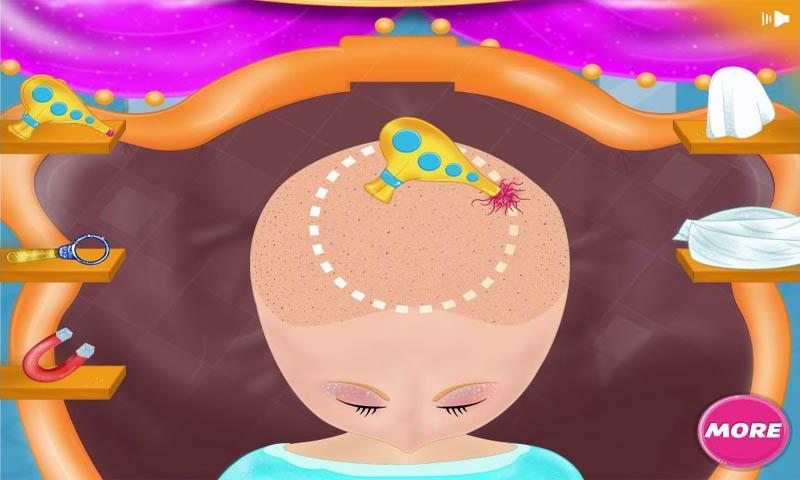 Brain Surgery